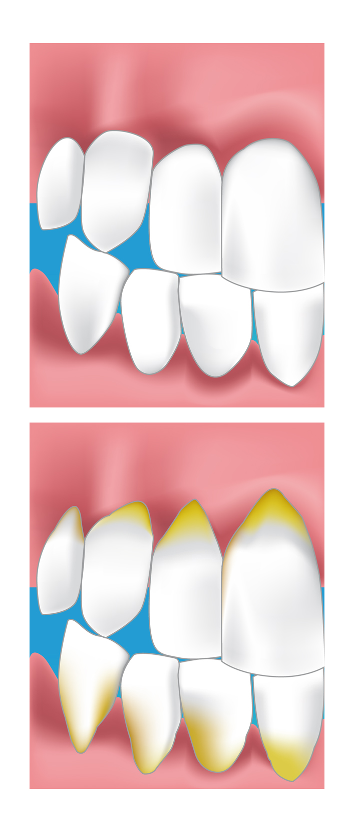 parodontie meaux